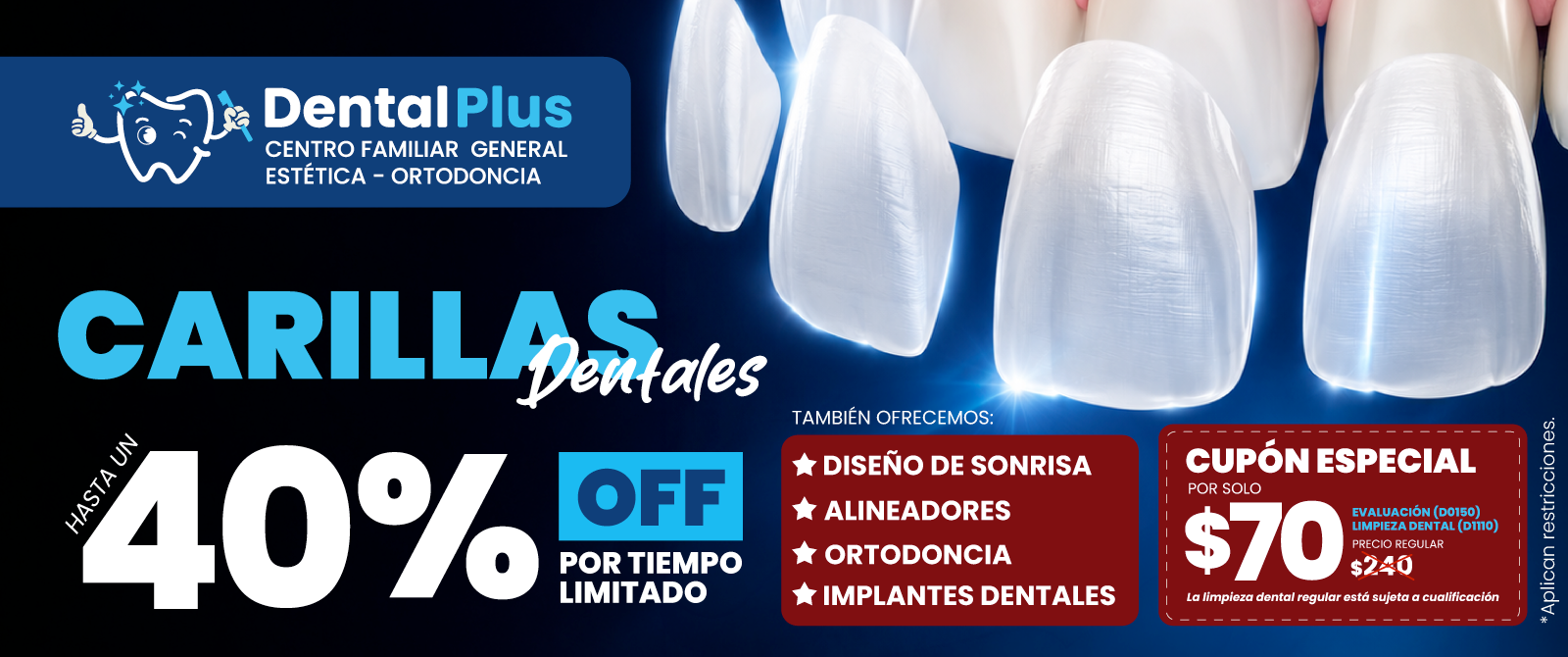 Veneers-Web-2